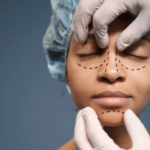 facial plastic surgeon