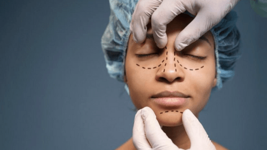 Understanding Rhinoplasty: Your Guide To Nose Surgery