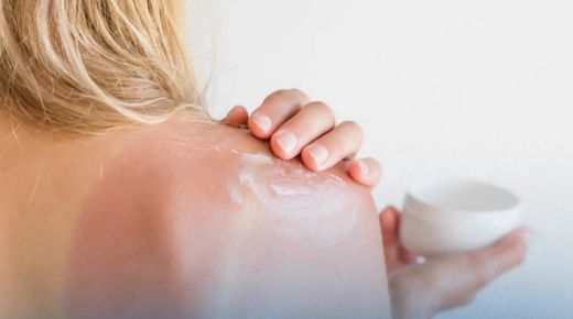 How Dermatologists Aid In Sunburn Treatment And Aftercare