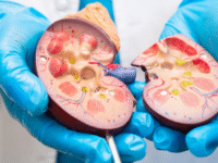 Nephrology Hospital in hyderabad