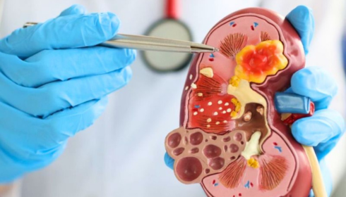 Discovering the Best Urology Hospital in Bangalore: Your Guide to Trusted Urological Care